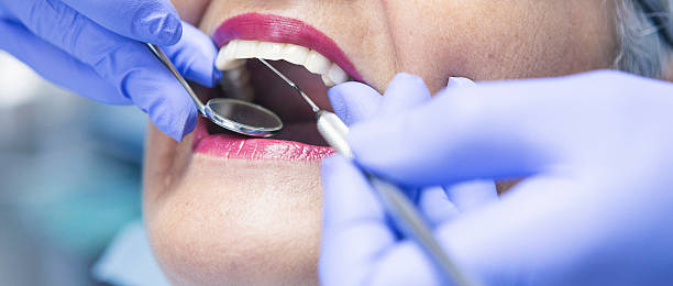 Best Root Canal Emergency Dentist  in Monticello, IL